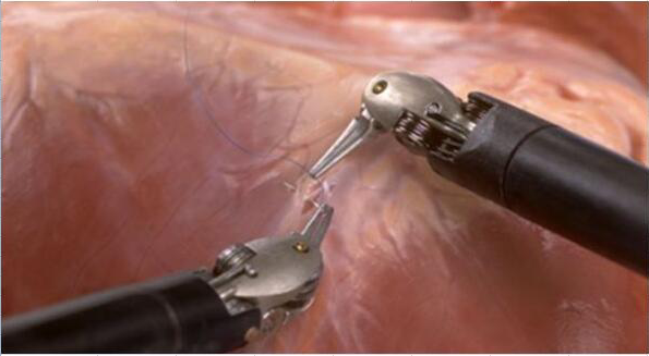 醫(yī)療手術(shù)機(jī)器人膠水